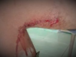 Deskonfia Sidadaun Indonesia Tiru Kanek Timor Oan Ida Iha Fatuk Metan